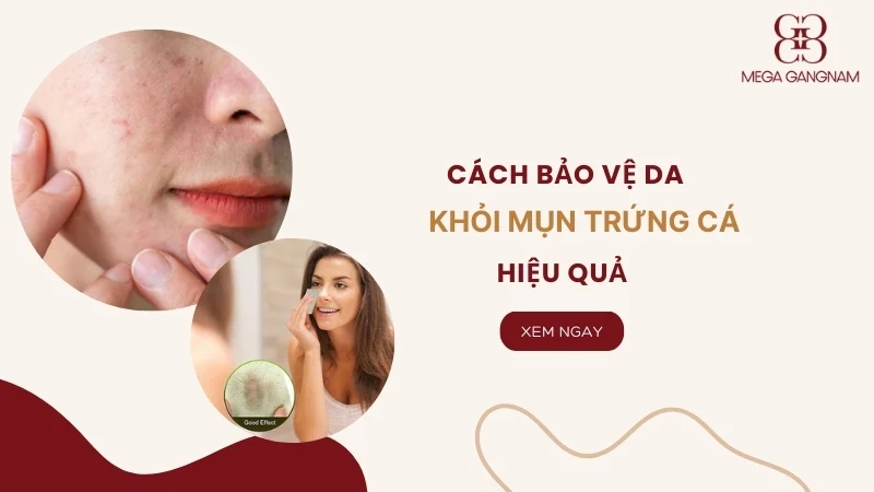 [Hướng dẫn] Cách bảo vệ da khỏi mụn trứng cá