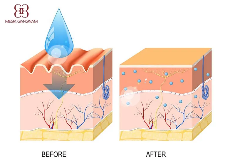 Bổ sung HA giúp da cân bằng nước, chữa lành tổn thương và tăng cường chức năng hàng rào 