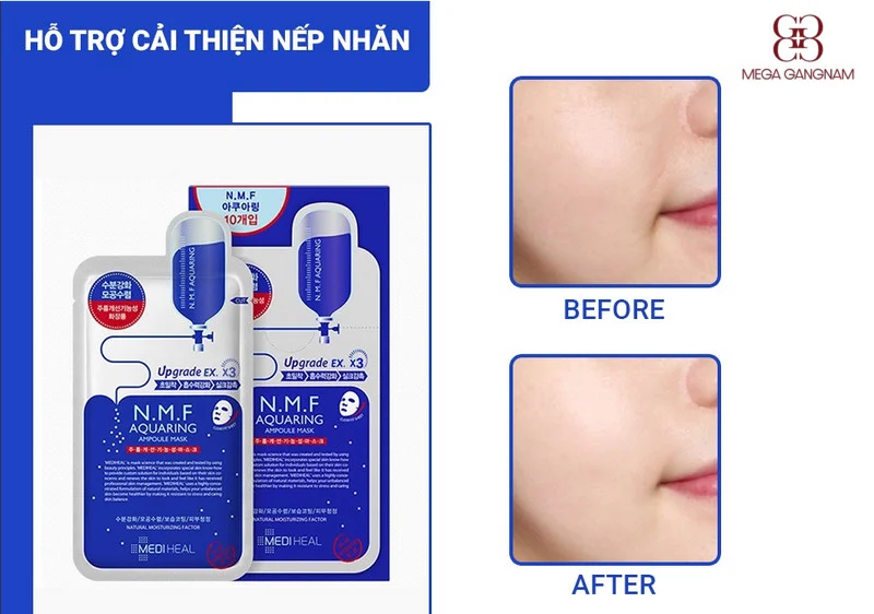 Mặt nạ mùa đông cho da hỗn hợp của Mediheal