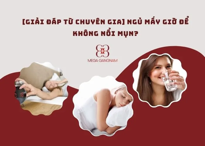 Ngủ mấy giờ để không nổi mụn?