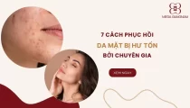 7 Cách phục hồi da mặt bị hư tổn từ chuyên gia 