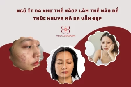 Ngủ ít da như thế nào?
