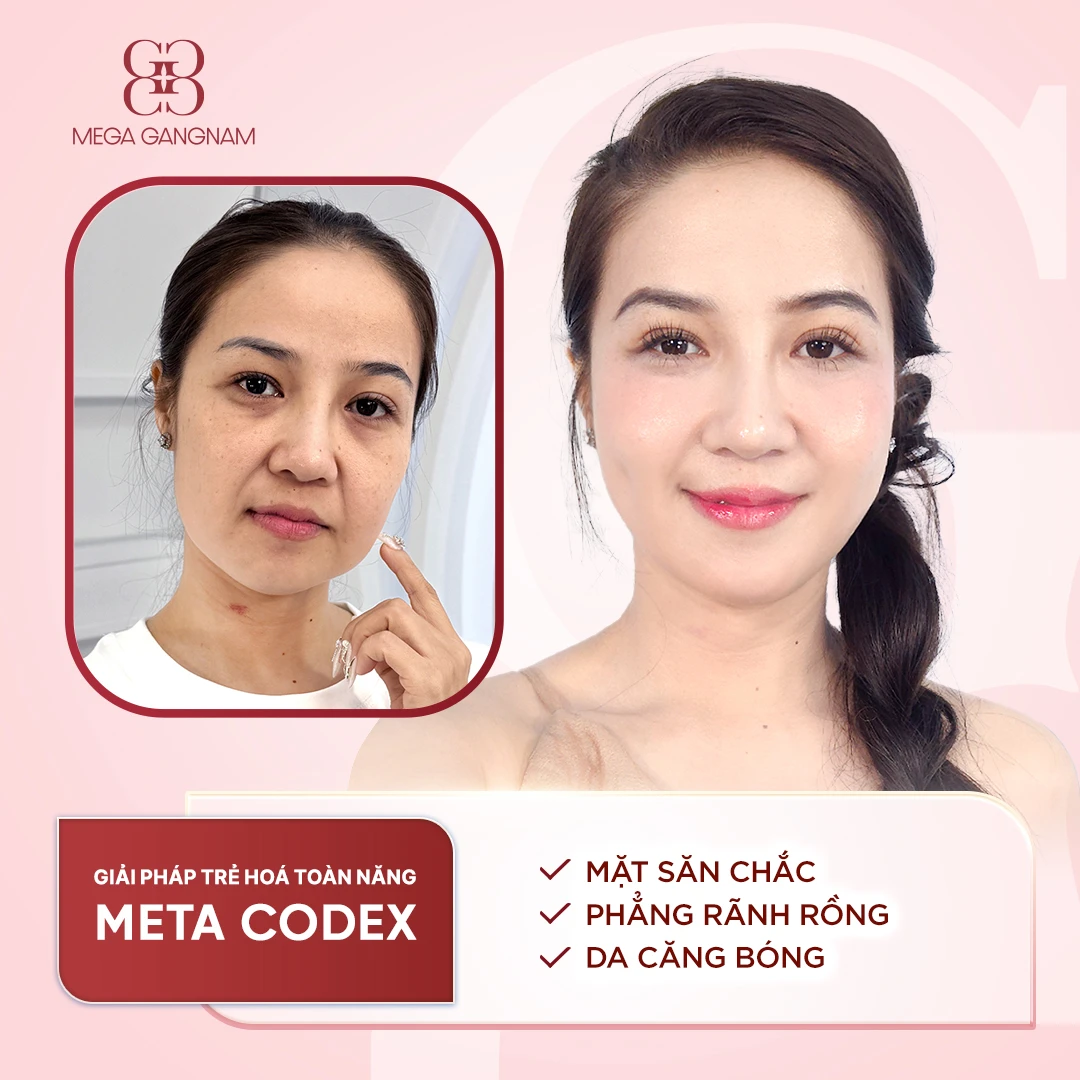 khach-hang-meta-codex-3